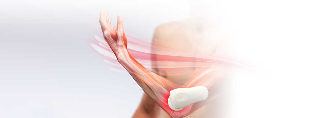 Tennis Elbow Treatment